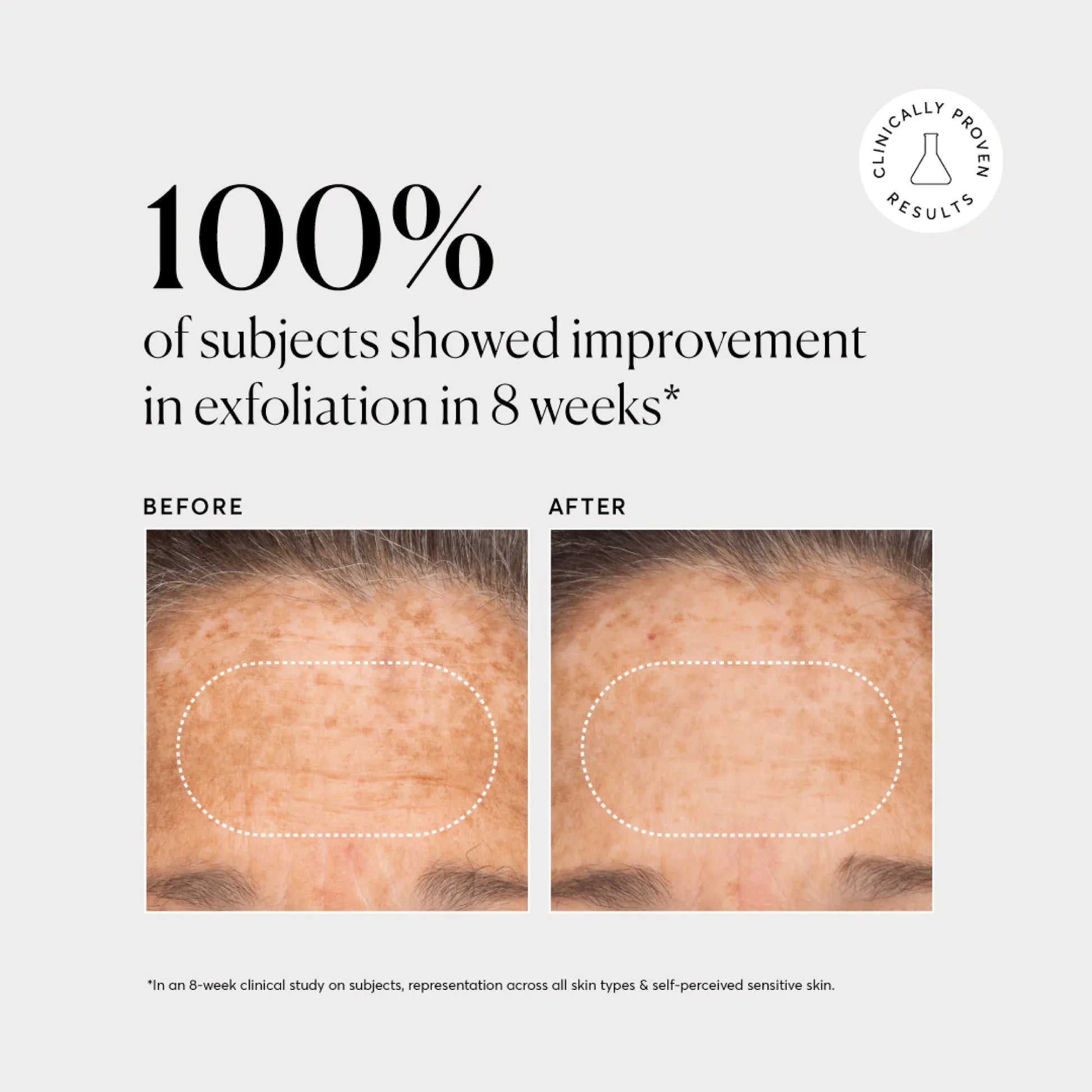 bha-liquid-exfoliant-2-u6 NATR-10027-Alt-Images-BHA-Liquid-Exfoliant-2_-03.webp